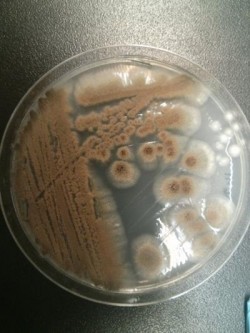 누룩곰팡이의 일종인 아스페르질루스 베르시콜로르(Aspergillus versicolor). 연구팀은 이 곰팡이에게서 카베페넴을 도와 NDM-1 유전자를 무력화시킬 수 있는 화학물질